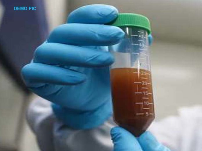 प्लाज्मा थेरेपी, Plasma therapy प्लाज्मा थेरेपी, Plasma therapy