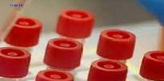 रेपिड टेस्ट, rapid test, प्रतीकात्मक तस्वीर