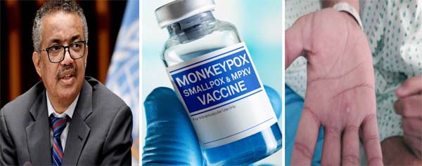vaccine