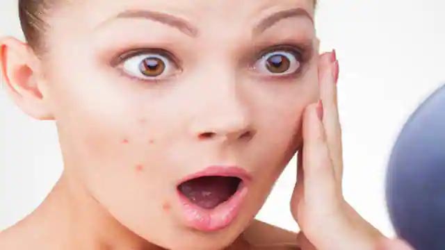 मुहासों से कैसे छुटकारा पाएं मुहासों से कैसे छुटकारा पाएं