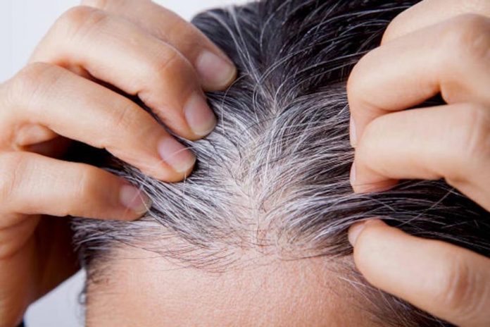 सफेद बालों को रोकने के लिए क्या करें
