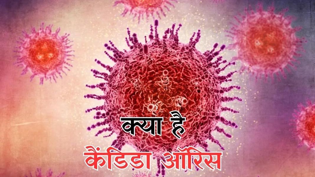 कैंडिडा ऑरिस के लक्षण