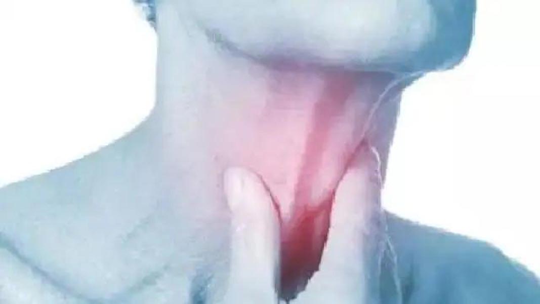 गले में संक्रमण की समस्या का जोखिम