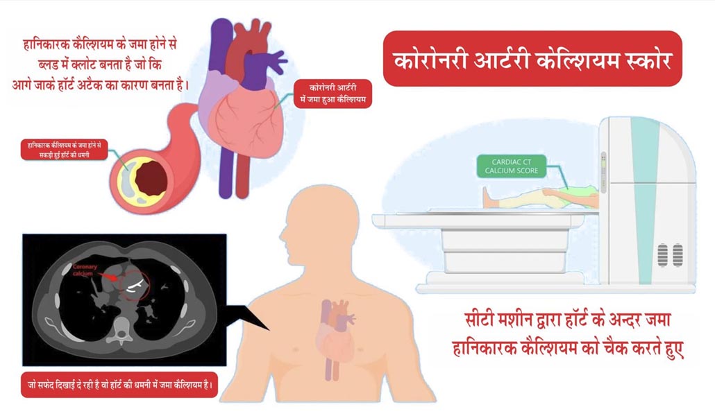वल्र्ड स्ट्रोक एसोसिएशन