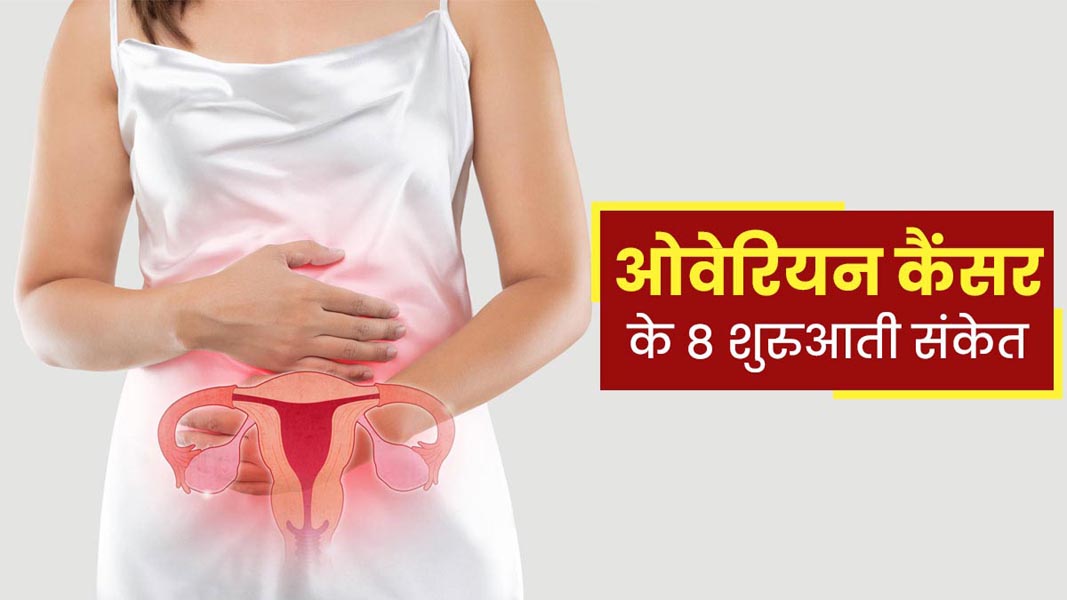 ओवेरियन कैंसर