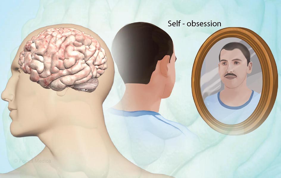नार्सिसिस्टिक पर्सनालिटी डिसऑर्डर?