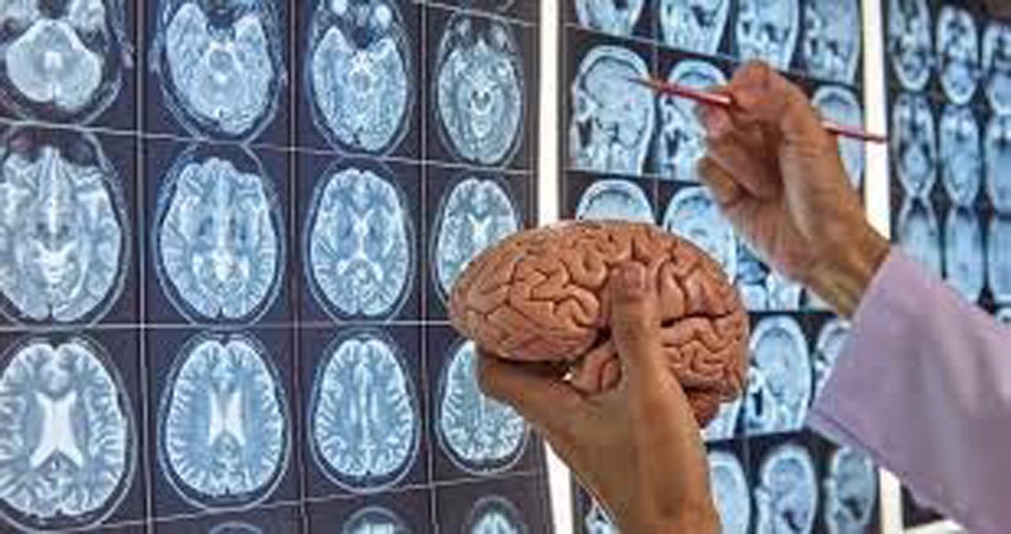 ब्रेन ब्लीड का कारण