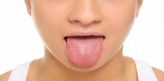 गर्म खाने से जली जीभ
