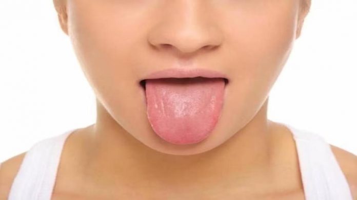 गर्म खाने से जली जीभ गर्म खाने से जली जीभ