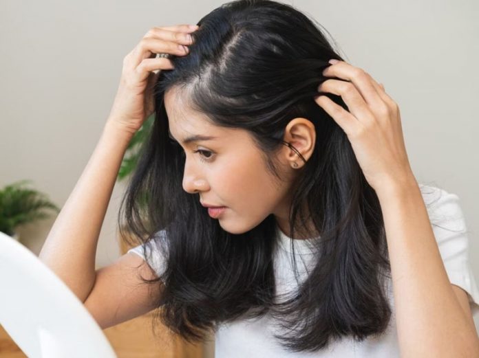 सफेद बाल सफेद बाल